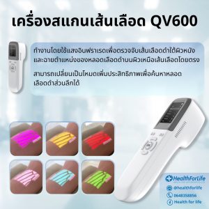 เครื่องสแกนเส้นเลือดQV600