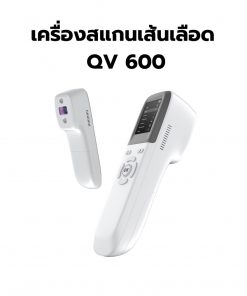 เครื่องสแกนเส้นเลือด QV600